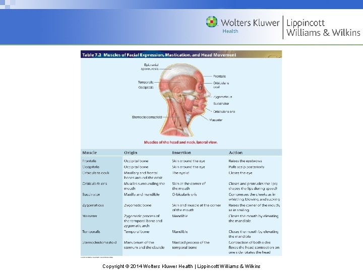 Copyright © 2014 Wolters Kluwer Health | Lippincott Williams & Wilkins 