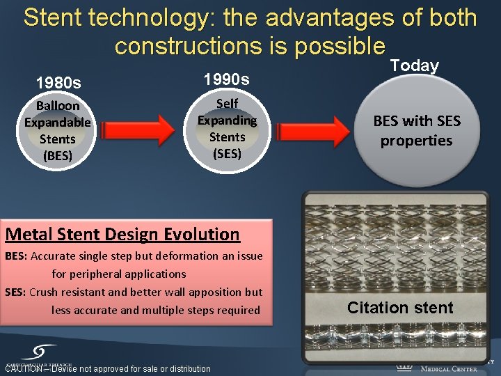 Stent technology: the advantages of both constructions is possible 1980 s 1990 s Balloon