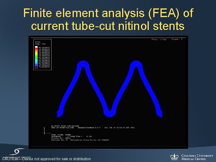 Finite element analysis (FEA) of current tube-cut nitinol stents CAUTION – Device not approved