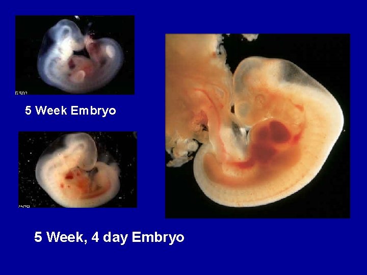 5 Week Embryo 5 Week, 4 day Embryo 