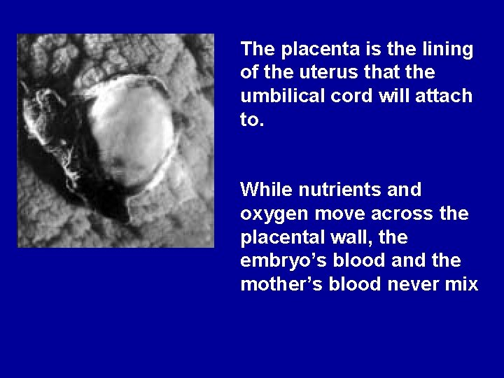 The placenta is the lining of the uterus that the umbilical cord will attach