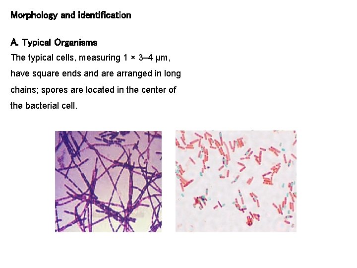 Morphology and identification A. Typical Organisms The typical cells, measuring 1 × 3– 4