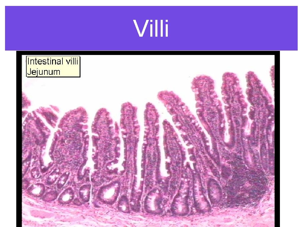 Villi 