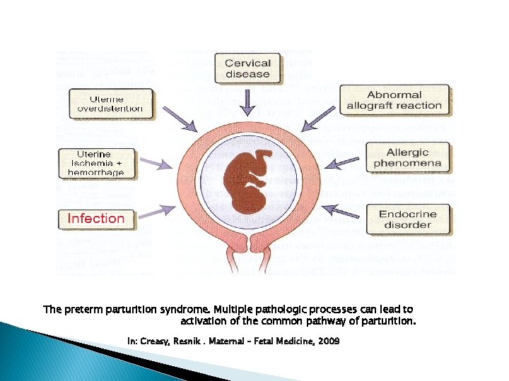 The preterm parturition syndrome. Multiple pathologic processes can lead to activation of the common
