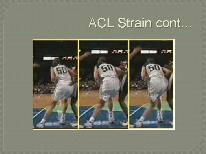 ACL Strain cont… 