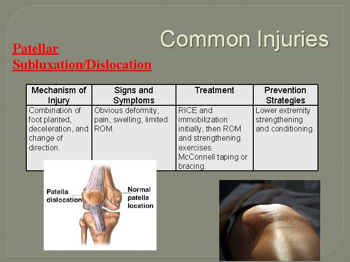 Patellar Subluxation/Dislocation Mechanism of Injury Common Injuries Signs and Symptoms Combination of Obvious deformity,