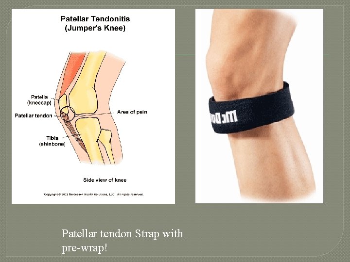 Patellar tendon Strap with pre-wrap! 