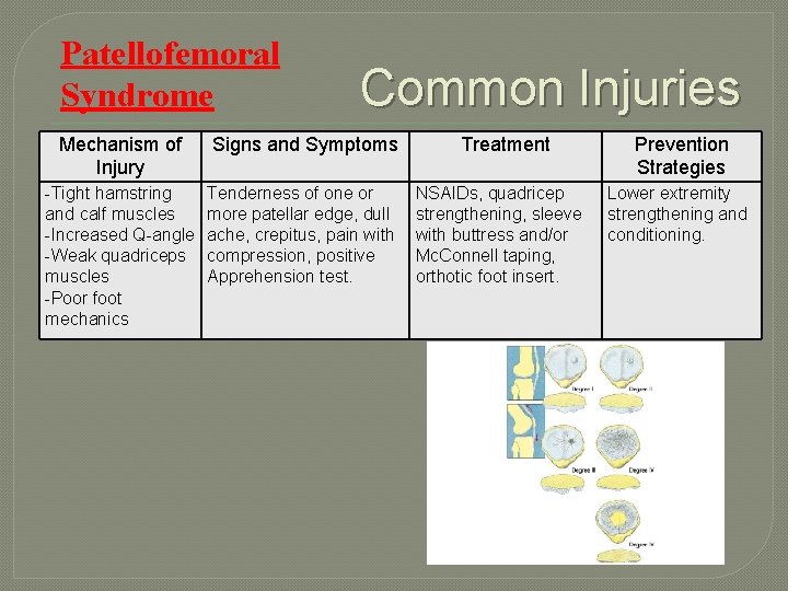 Patellofemoral Syndrome Common Injuries Mechanism of Injury Signs and Symptoms -Tight hamstring and calf