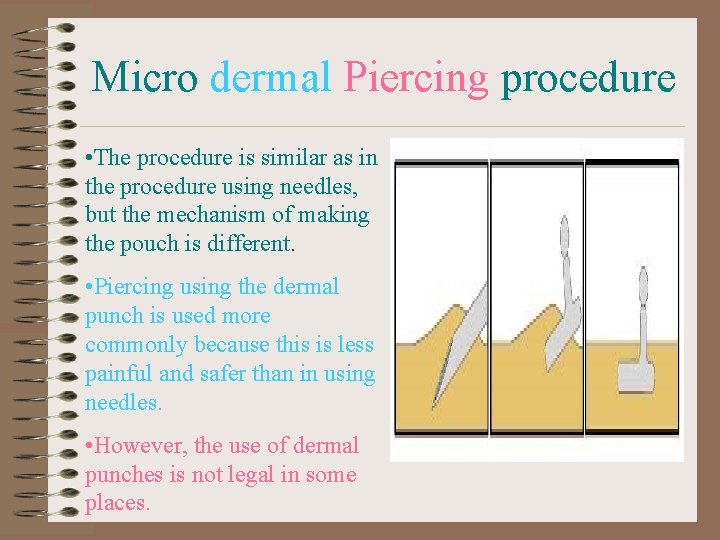 Micro dermal Piercing procedure • The procedure is similar as in the procedure using