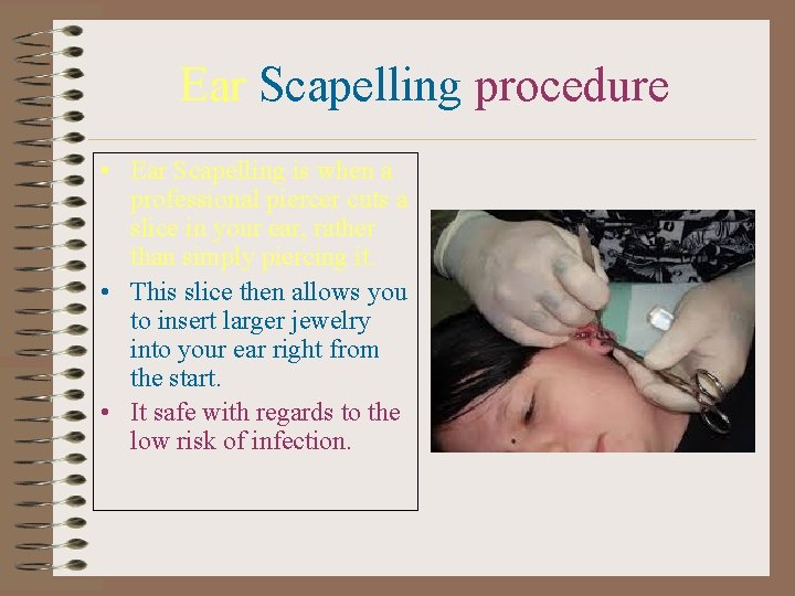 Ear Scapelling procedure • Ear Scapelling is when a professional piercer cuts a slice