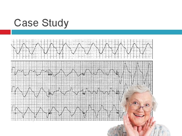 Case Study 