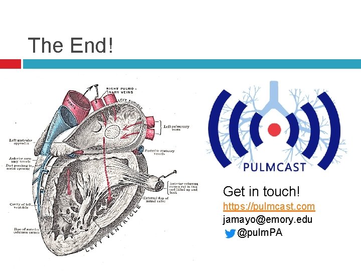 The End! Get in touch! https: //pulmcast. com jamayo@emory. edu @pulm. PA 