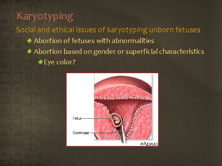 Karyotyping Social and ethical issues of karyotyping unborn fetuses Abortion of fetuses with abnormalities