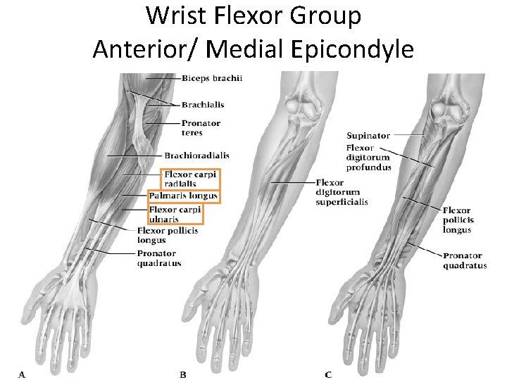 Wrist Flexor Group Anterior/ Medial Epicondyle 