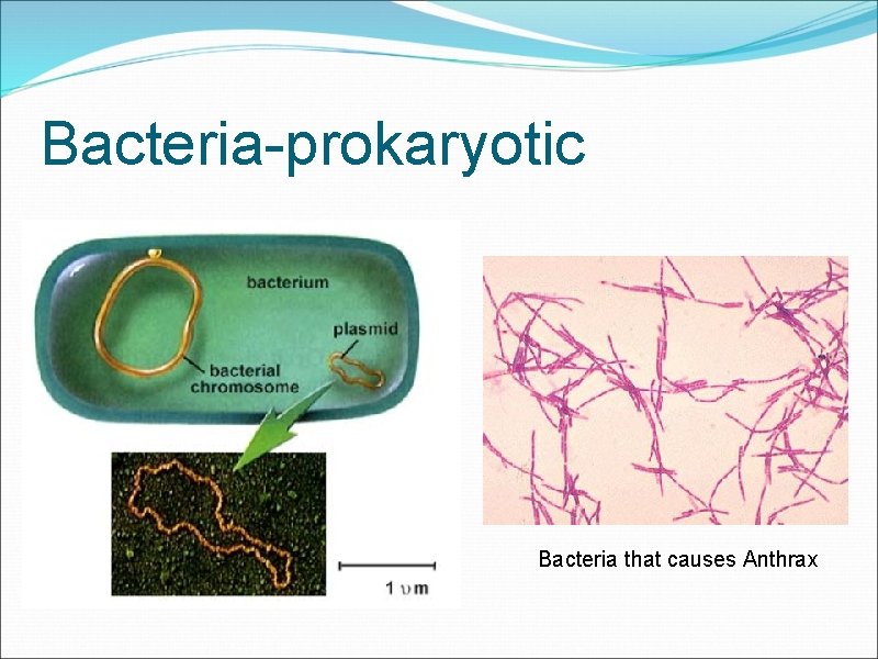 Bacteria-prokaryotic Bacteria that causes Anthrax 