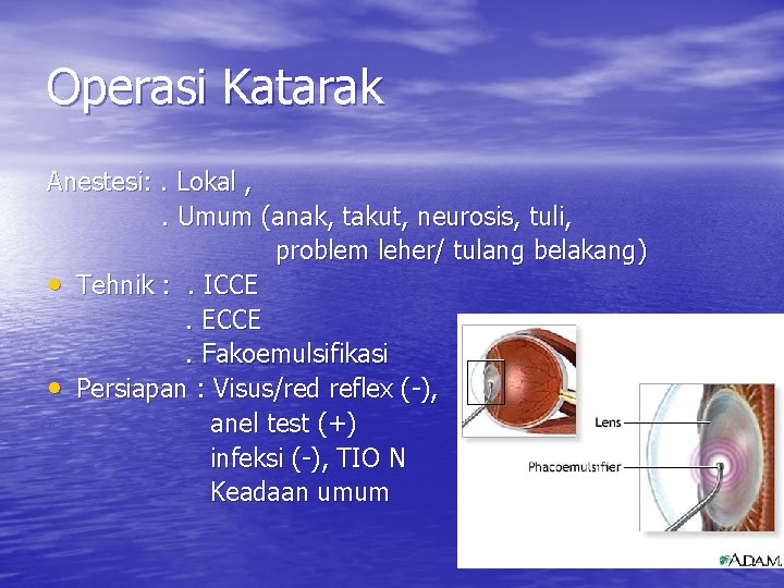 Operasi Katarak Anestesi: . Lokal , . Umum (anak, takut, neurosis, tuli, problem leher/