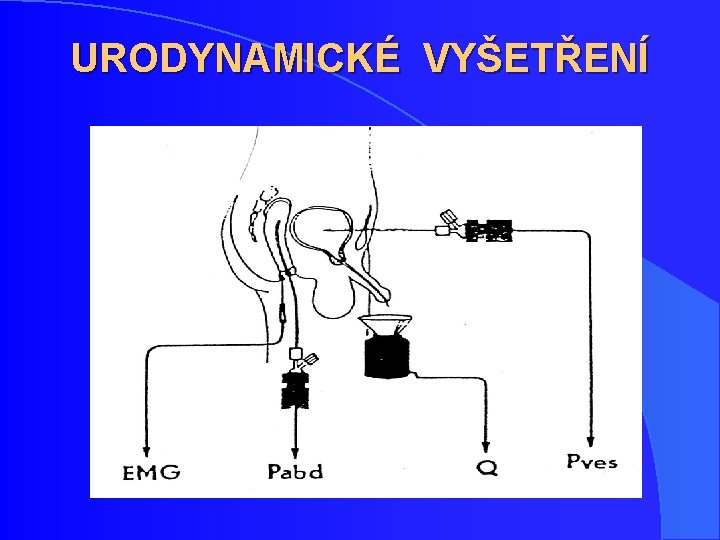 URODYNAMICKÉ VYŠETŘENÍ URODYNAMICKÉ VYŠETŘENÍ