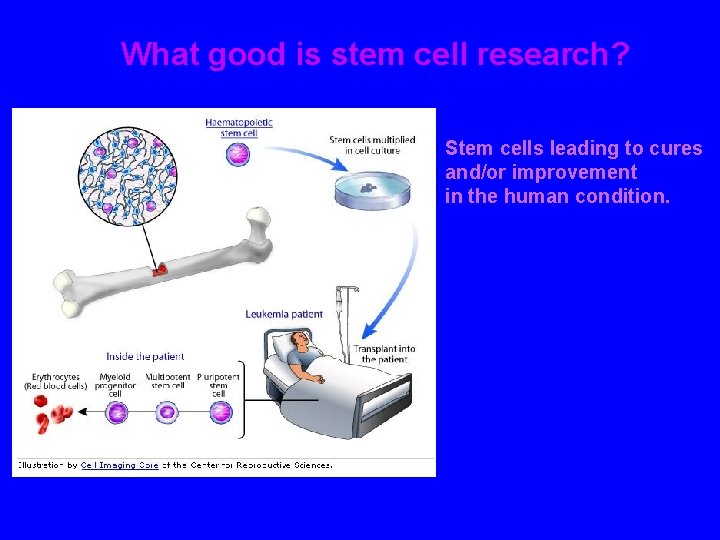 What good is stem cell research? Stem cells leading to cures and/or improvement in