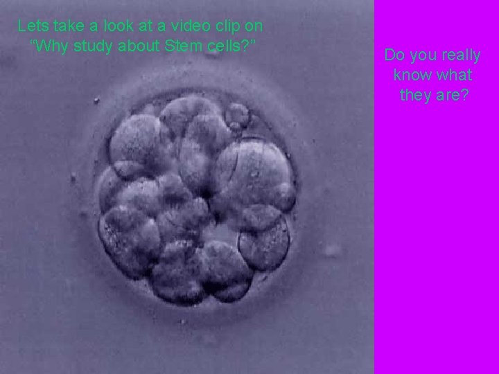 Lets take a look at a video clip on “Why study about Stem cells?