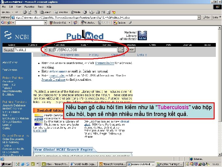 Pub. Med query box Nếu bạn gõ câu hỏi tìm kiếm như là “Tuberculosis”