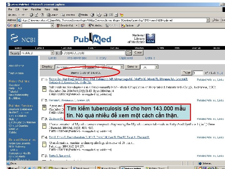Results display Tìm kiếm tuberculosis sẽ cho hơn 143. 000 mẩu tin. Nó quá