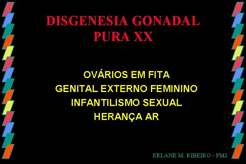 DISGENESIA GONADAL PURA XX OVÁRIOS EM FITA GENITAL EXTERNO FEMININO INFANTILISMO SEXUAL HERANÇA AR