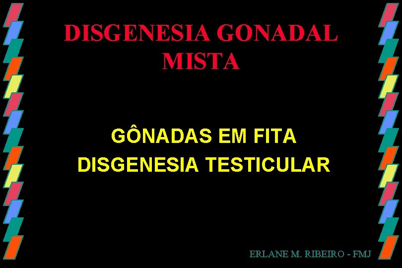 DISGENESIA GONADAL MISTA GÔNADAS EM FITA DISGENESIA TESTICULAR ERLANE M. RIBEIRO - FMJ 