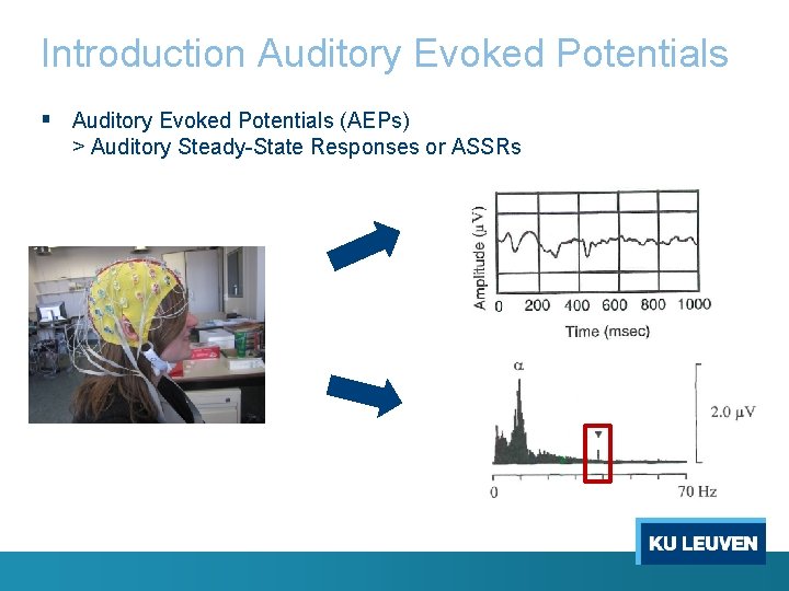 Introduction Auditory Evoked Potentials § Auditory Evoked Potentials (AEPs) > Auditory Steady-State Responses or