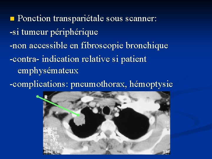 Ponction transpariétale sous scanner: -si tumeur périphérique -non accessible en fibroscopie bronchique -contra- indication