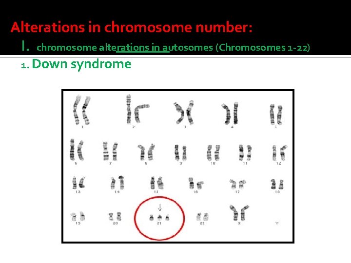 Alterations in chromosome number: I. chromosome alterations in autosomes (Chromosomes 1 -22) 1. Down