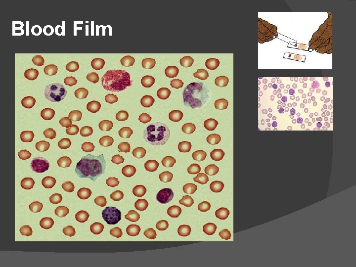 Blood Film 