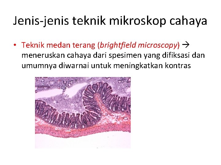 Jenis-jenis teknik mikroskop cahaya • Teknik medan terang (brightfield microscopy) meneruskan cahaya dari spesimen