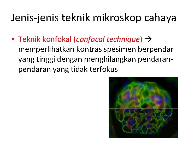 Jenis-jenis teknik mikroskop cahaya • Teknik konfokal (confocal technique) memperlihatkan kontras spesimen berpendar yang