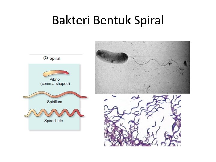 Bakteri Bentuk Spiral 
