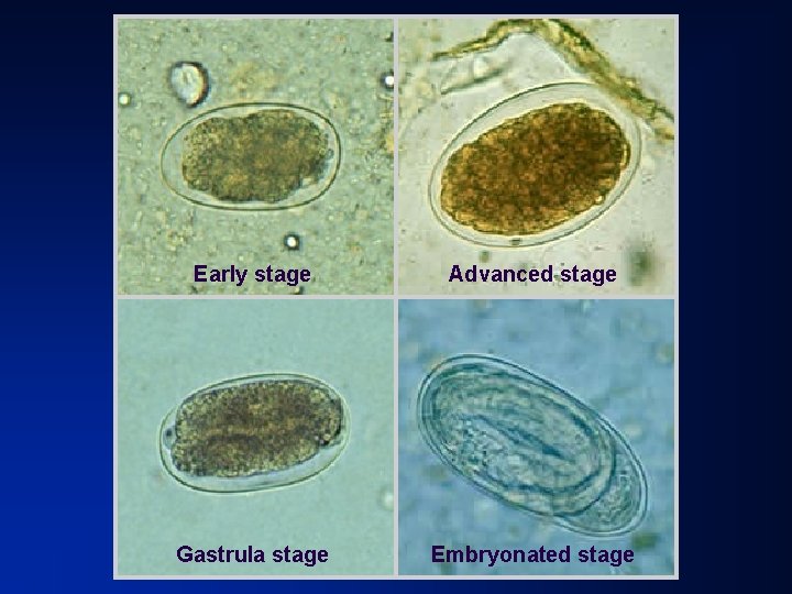 Early stage Advanced stage Gastrula stage Embryonated stage 