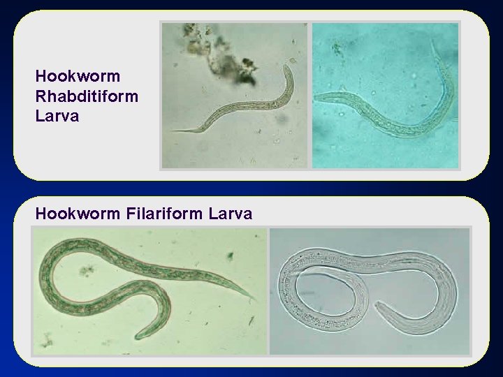 Hookworm Rhabditiform Larva Hookworm Filariform Larva 