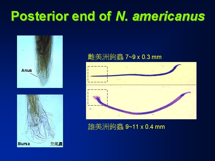 Posterior end of N. americanus 雌美洲鉤蟲 7~9 x 0. 3 mm Anus 雄美洲鉤蟲 9~11