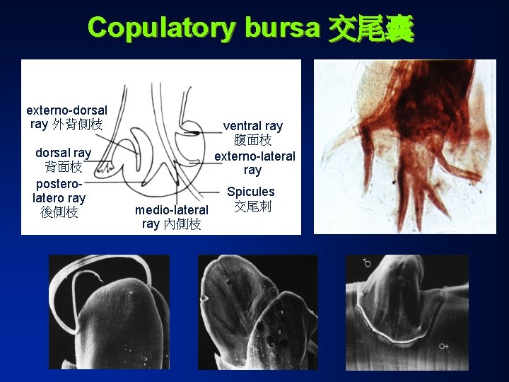 Copulatory bursa 交尾囊 externo-dorsal ray 外背側枝 dorsal ray 背面枝 posterolatero ray 後側枝 ventral ray