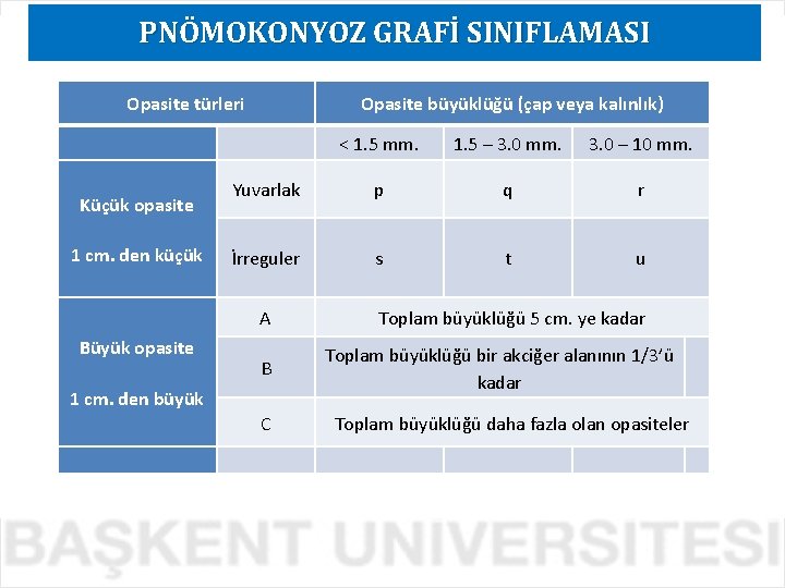 PNÖMOKONYOZ GRAFİ SINIFLAMASI Opasite türleri Küçük opasite 1 cm. den küçük Opasite büyüklüğü (çap