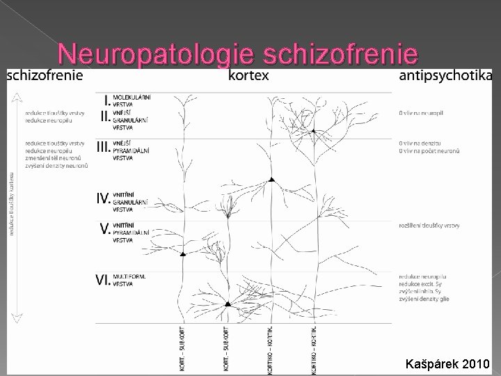 Neuropatologie schizofrenie Kašpárek 2010 