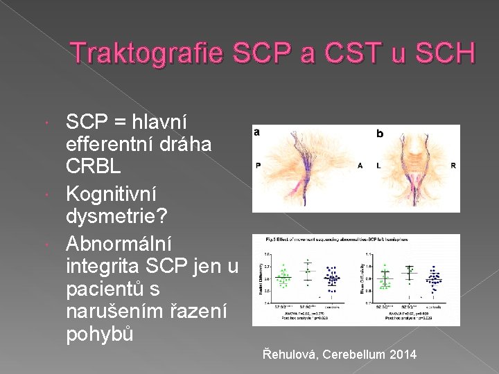 Traktografie SCP a CST u SCH SCP = hlavní efferentní dráha CRBL Kognitivní dysmetrie?