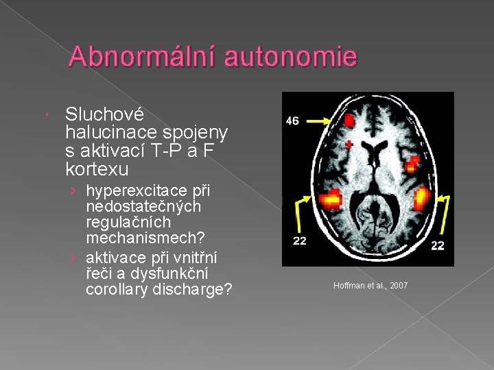 Abnormální autonomie Sluchové halucinace spojeny s aktivací T-P a F kortexu › hyperexcitace při