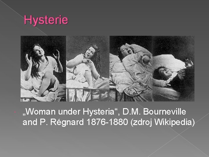 Hysterie „Woman under Hysteria“, D. M. Bourneville and P. Régnard 1876 -1880 (zdroj Wikipedia)