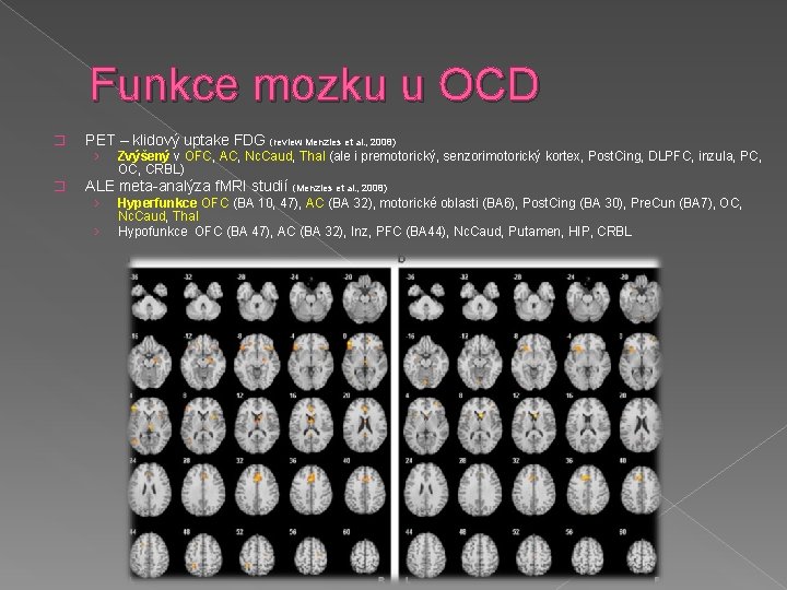 Funkce mozku u OCD � PET – klidový uptake FDG (review Menzies et al.