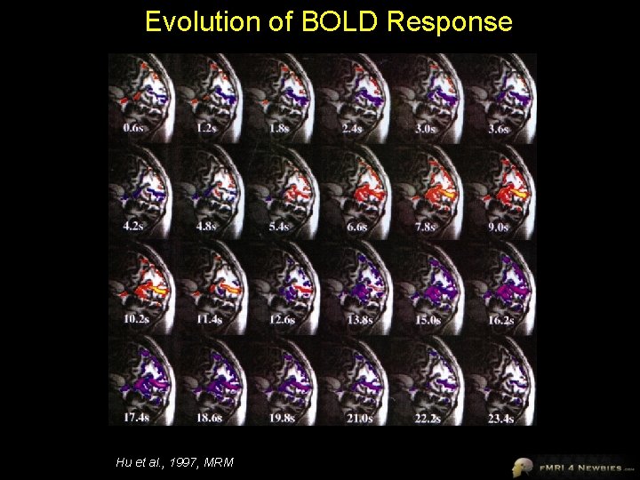 Evolution of BOLD Response Hu et al. , 1997, MRM 