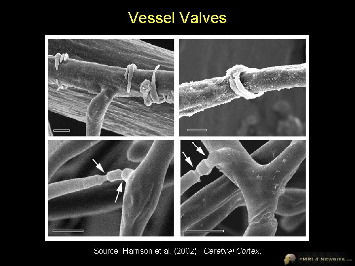 Vessel Valves Source: Harrison et al. (2002). Cerebral Cortex. 
