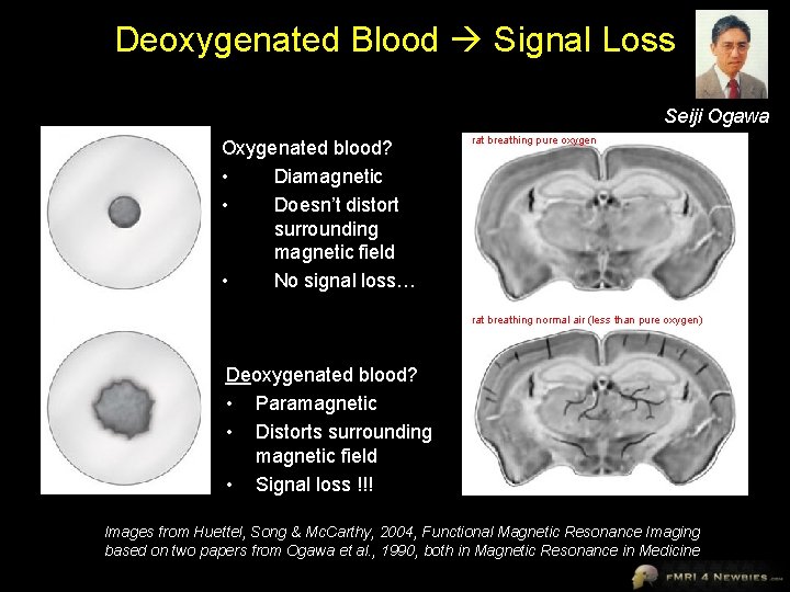 Deoxygenated Blood Signal Loss Seiji Ogawa Oxygenated blood? • Diamagnetic • Doesn’t distort surrounding