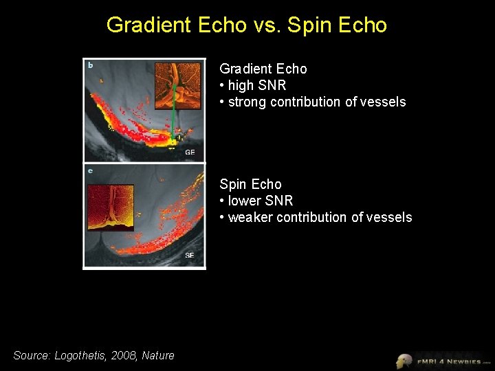 Gradient Echo vs. Spin Echo Gradient Echo • high SNR • strong contribution of