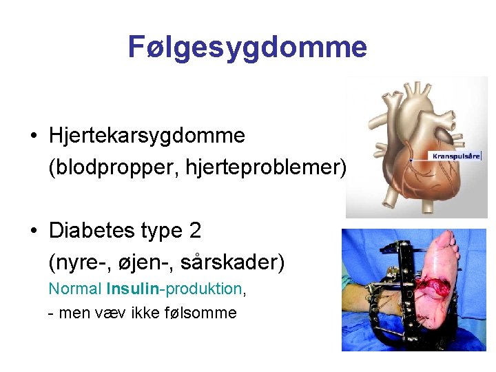Følgesygdomme • Hjertekarsygdomme (blodpropper, hjerteproblemer) • Diabetes type 2 (nyre-, øjen-, sårskader) Normal Insulin-produktion,
