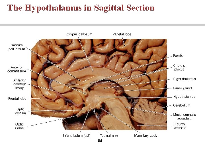The Hypothalamus in Sagittal Section 